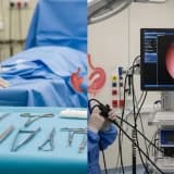 Endoskopik Mide Küçültme Gerçekten Ameliyatın Yerini Alabilir mi?