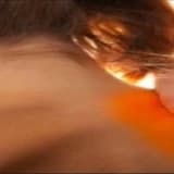 Kulunç Nedir? Nasıl Oluşur? Fizyoterapinin Ağrı Azaltmadaki Önemi