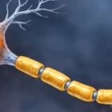 Multiple Skleroz ve Rehabilitasyonu