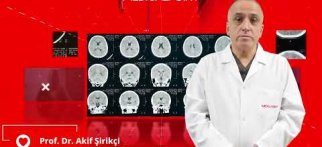 İnme (Felç) - Girişimsel Radyoloji / Nöroradyoloji Uzmanı Prof. Dr. Akif Şirikçi